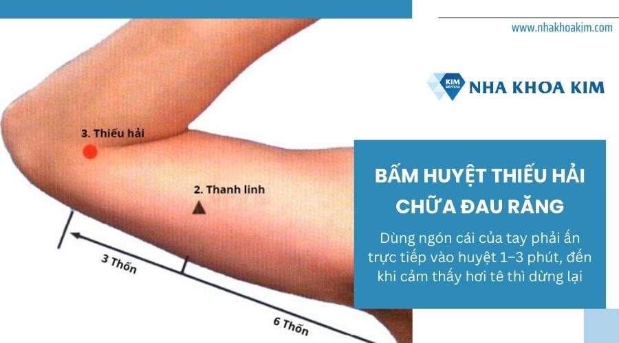 cách bấm huyệt thiếu hải