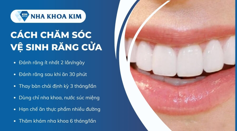 Cách chăm sóc vệ sinh răng cửa tốt