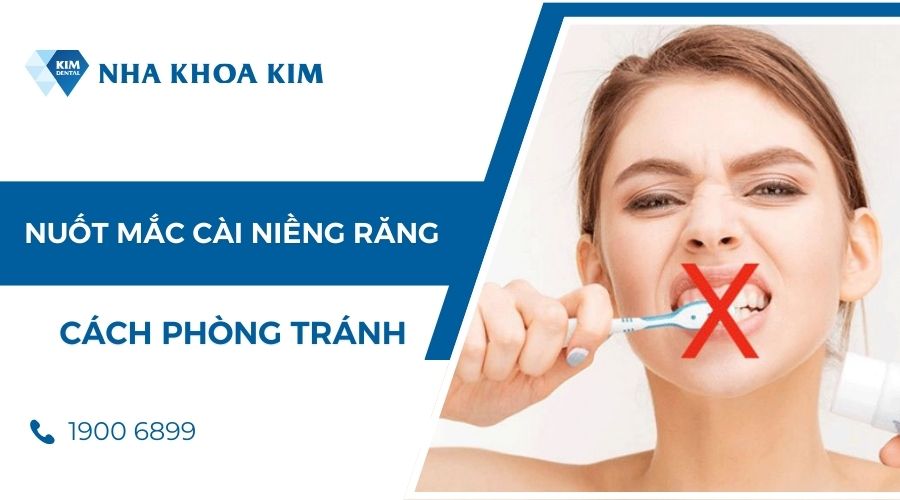 cách phòng tránh bị mắc cài bung rớt