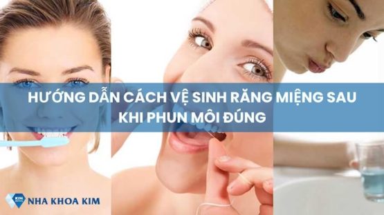 Hướng dẫn cách vệ sinh răng miệng sau khi phun môi đúng