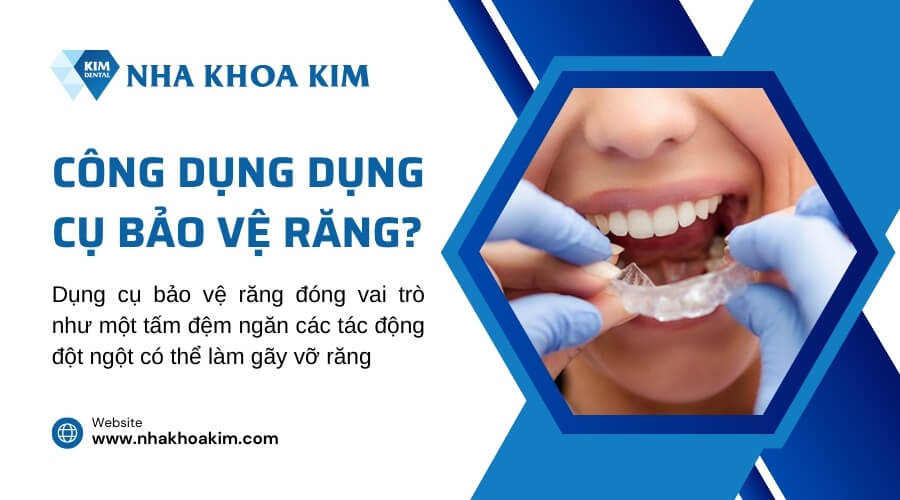 Tại sao nên dùng dụng cụ bảo vệ răng?