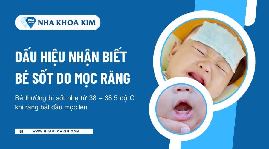 Dấu hiệu nhận biết bé sốt do mọc răng