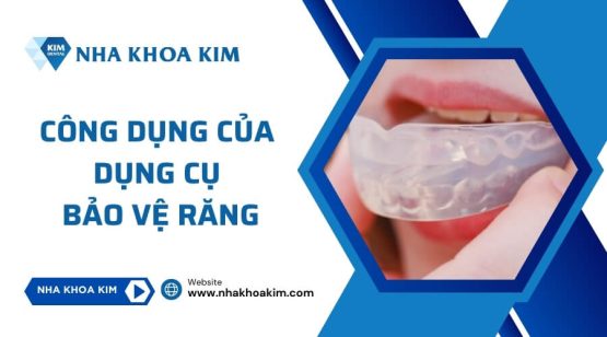 Công dụng của dụng cụ bảo vệ răng