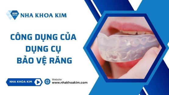 Công dụng của dụng cụ bảo vệ răng