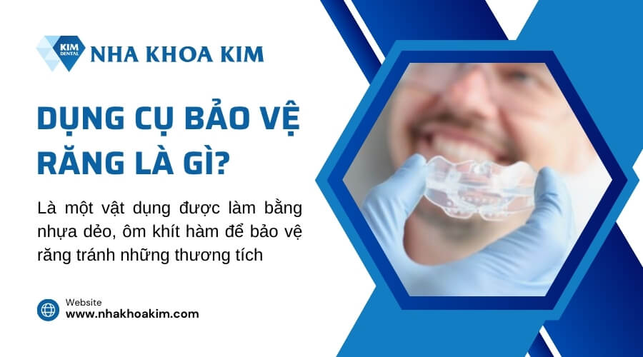 Dụng cụ bảo vệ răng là gì?