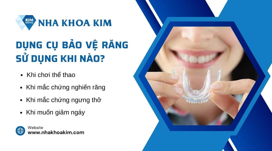 Dụng cụ bảo vệ răng được sử dụng khi nào?
