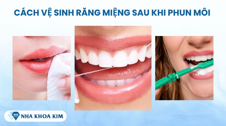 Hướng dẫn cách vệ sinh răng miệng sau khi phun môi đúng