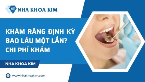 Khám răng định kỳ bao lâu một lần? Chi phí khám