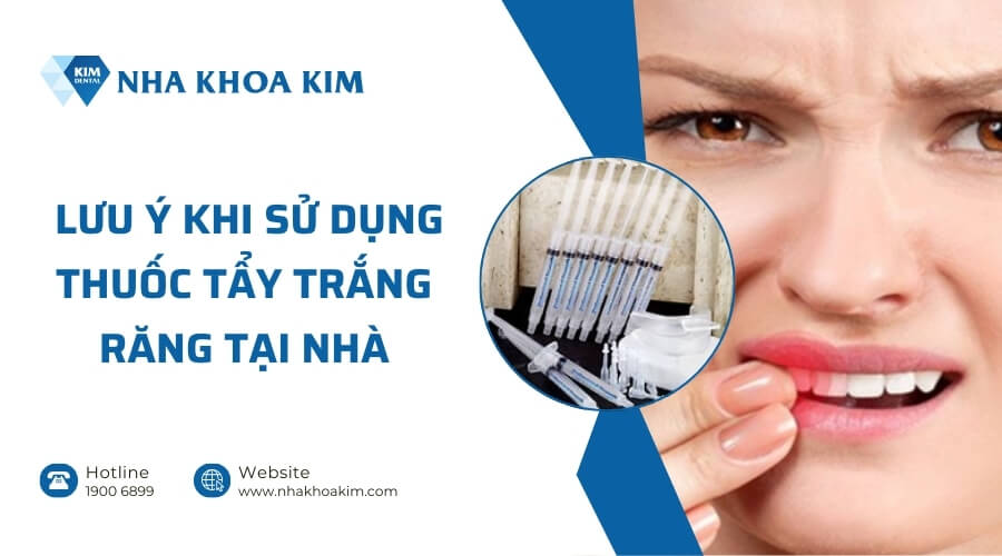 Những điều cần lưu ý khi sử dụng thuốc tẩy trắng răng tại nhà