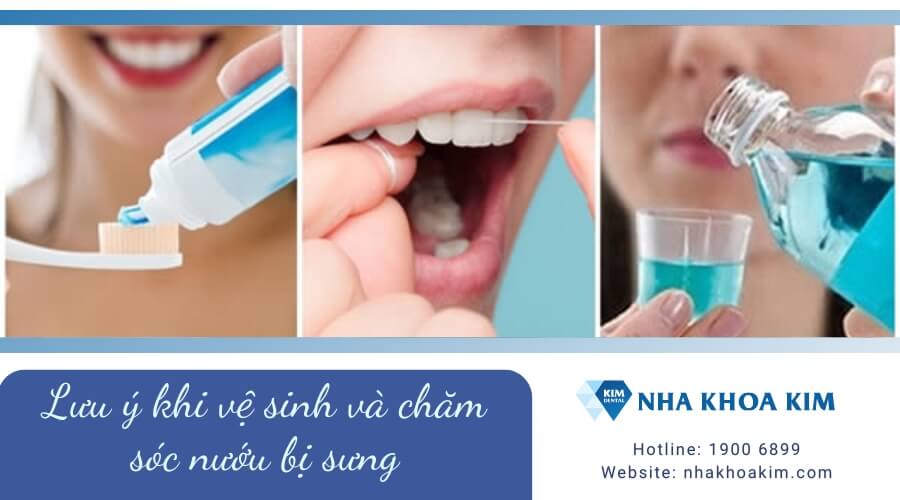 Lưu ý khi vệ sinh và chăm sóc nướu bị sưng