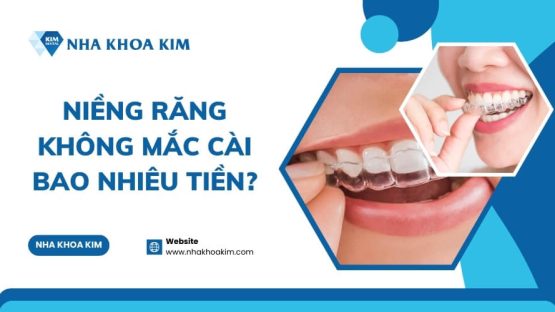 Niềng Răng Không Mắc Cài Giá Bao Nhiêu Tiền?