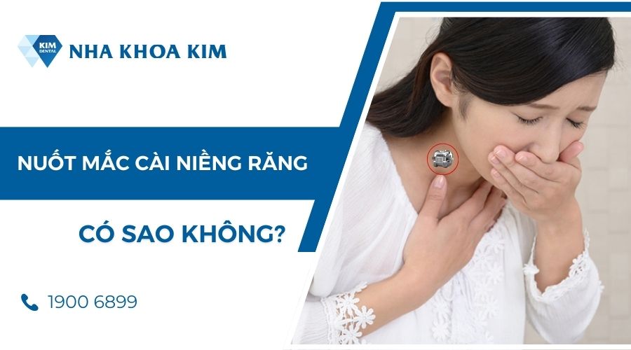 lỡ nuốt mắc cài có sao không