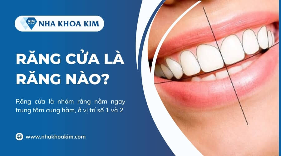 Răng cửa là những răng nào?