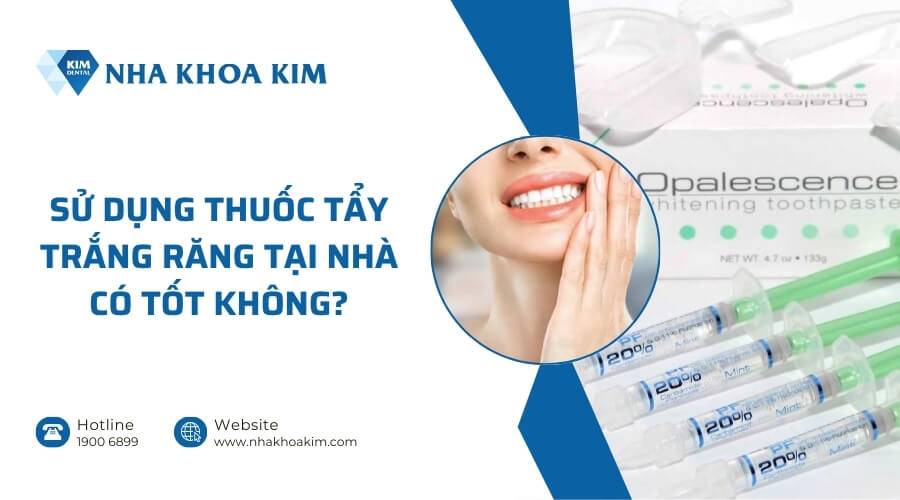 Có nên sử dụng thuốc tẩy trắng răng tại nhà không?