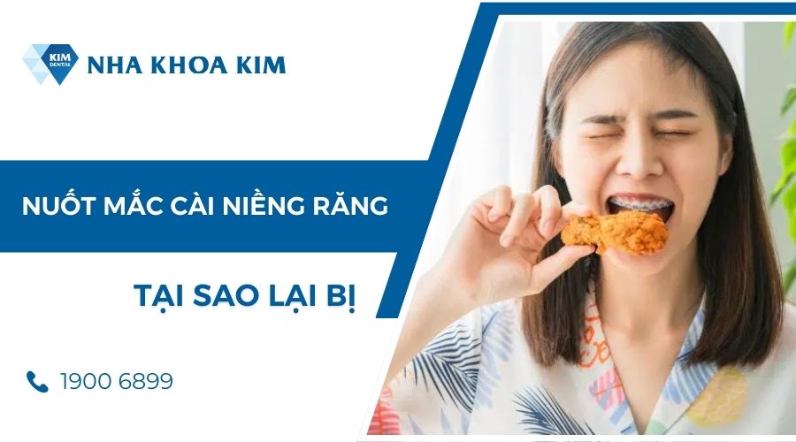 tại sao lại bị nuốt mắc cài