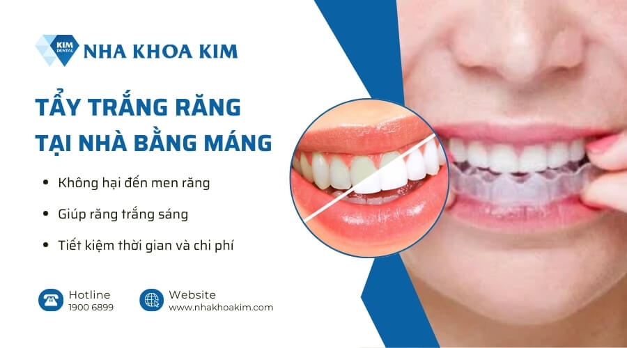Các phương pháp tẩy trắng răng tại nhà hiện nay