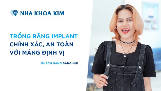 Trồng răng Implant an toàn, chính xác với máng định vị tại Nha Khoa Kim