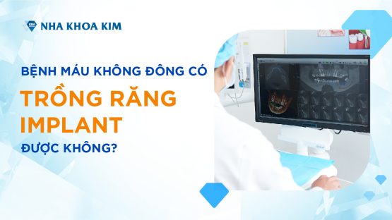 Bệnh máu không đông có trồng răng Implant được không?