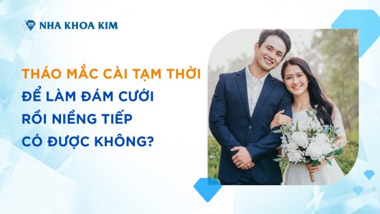 Tháo mắc cài tạm thời để làm đám cưới có được không?