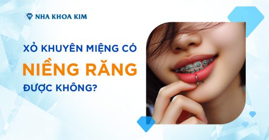 Xỏ khuyên miệng có niềng răng được không?