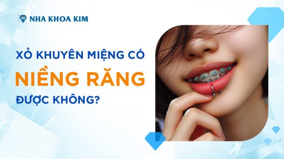 Xỏ khuyên miệng có niềng răng được không?