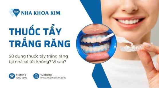 Sử dụng thuốc tẩy trắng răng tại nhà có tốt không? Vì sao?