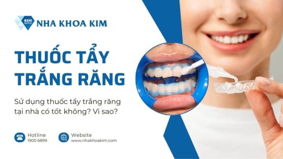 Sử dụng thuốc tẩy trắng răng tại nhà có tốt không? Vì sao?