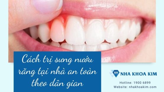 Cách trị sưng nướu răng tại nhà an toàn theo dân gian