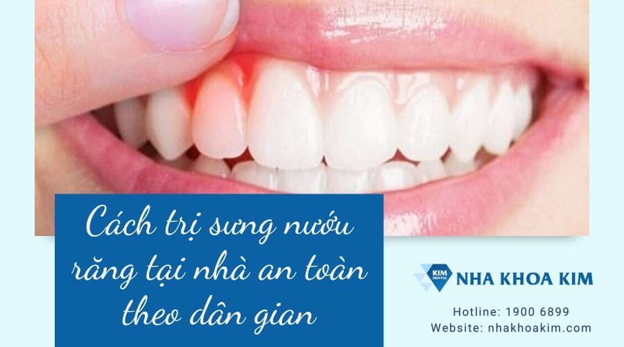 Cách trị sưng nướu răng tại nhà an toàn theo dân gian