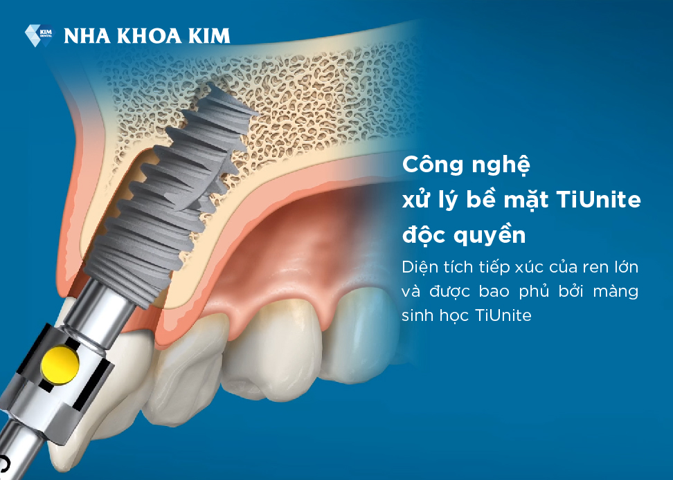Công nghệ xử lý độc quyền