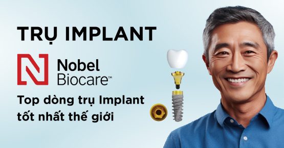 Trụ Implant Nobel – Top dòng trụ Implant tốt nhất thế giới