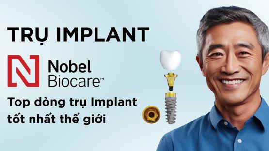 Trụ Implant Nobel – Top dòng trụ Implant tốt nhất thế giới