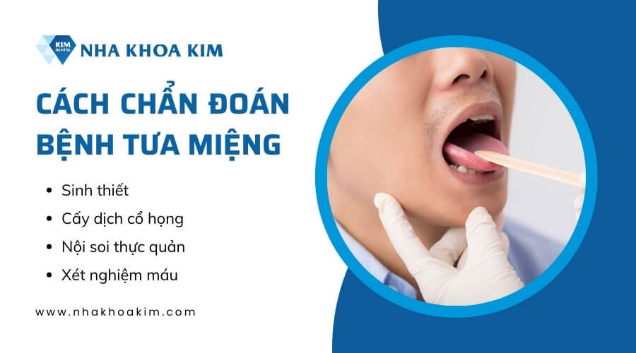 Phương pháp chẩn đoán bệnh tưa miệng
