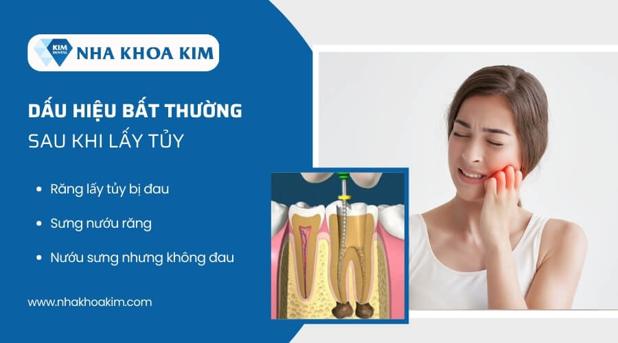 Những triệu chứng sau khi lấy tủy răng