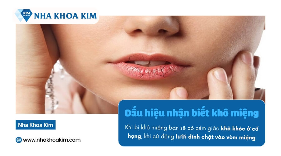Dấu hiệu nhận biết khô miệng