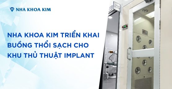 Nha Khoa Kim triển khai buồng thổi sạch cho khu thủ thuật Implant