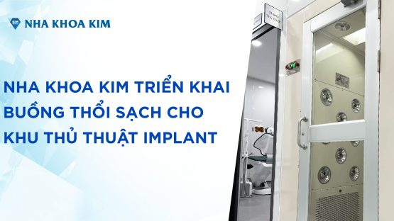 Nha Khoa Kim triển khai buồng thổi sạch cho khu thủ thuật Implant