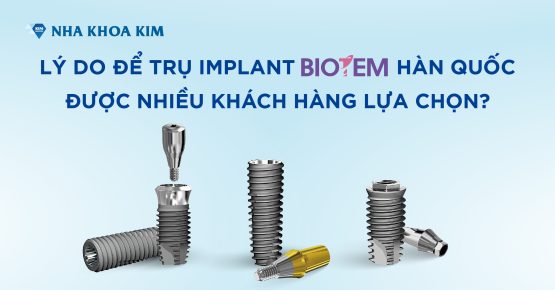 Lý do để trụ Implant Biotem Hàn Quốc được nhiều khách hàng lựa chọn?