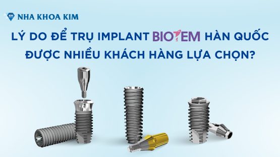 Lý do để trụ Implant Biotem Hàn Quốc được nhiều khách hàng lựa chọn?