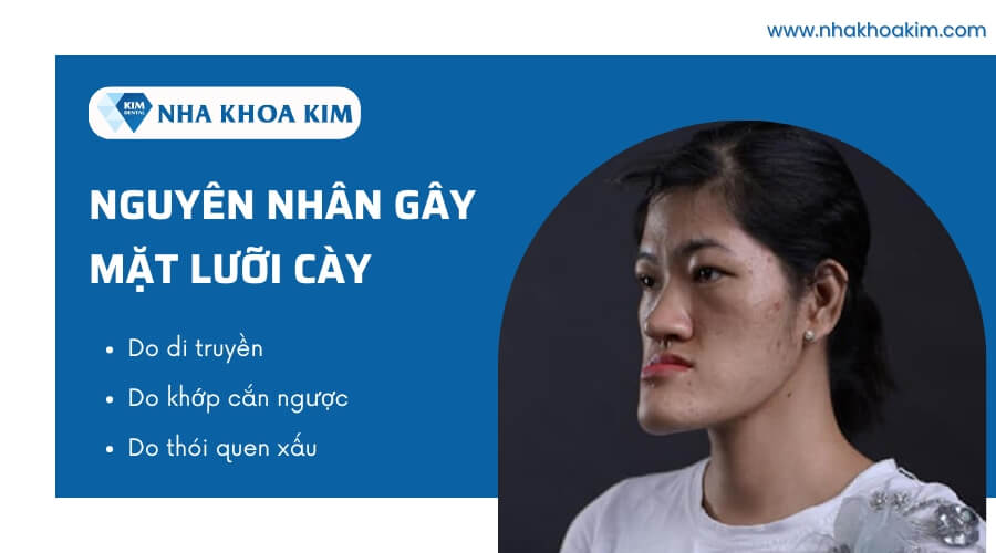 Nguyên nhân gây ra tình trạng mặt lưỡi cày