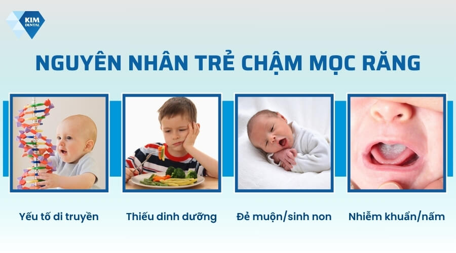 Nguyên nhân trẻ chậm mọc răng