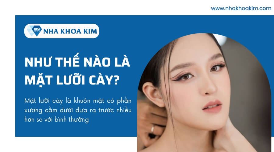 4. Lời Khuyên Từ Chuyên Gia