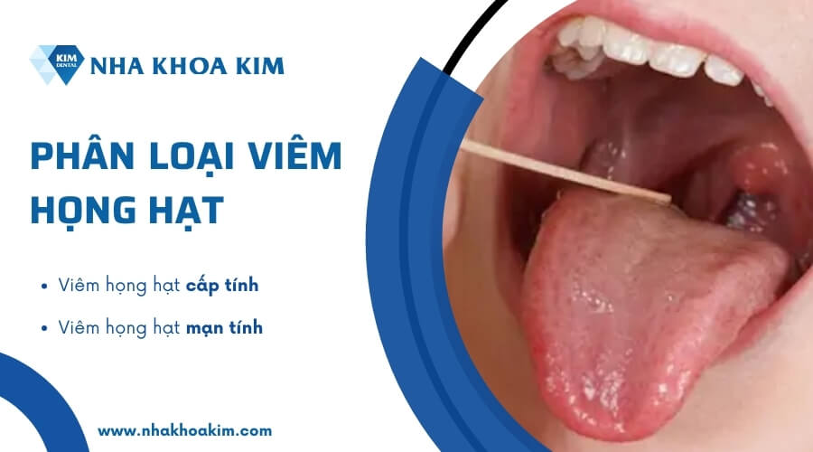 Phân loại viêm họng hạt