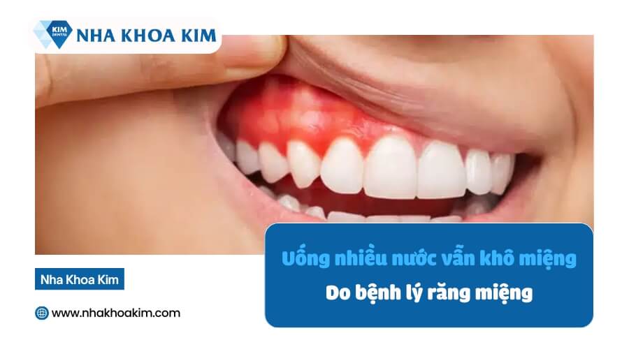 uống nhiều nước nhưng vẫn khô miệng do các bệnh về răng