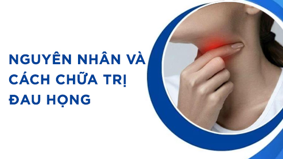 Đau họng: Nguyên nhân, triệu chứng và cách chữa trị