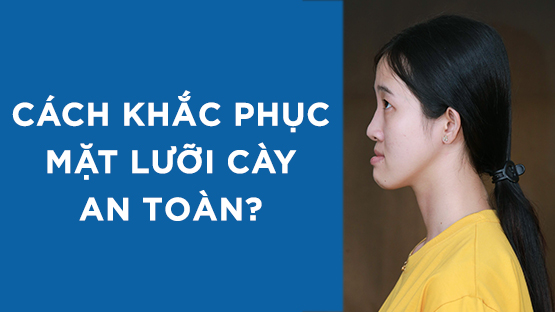 Mặt lưỡi cày là gì? Cách khắc phục mặt gãy an toàn