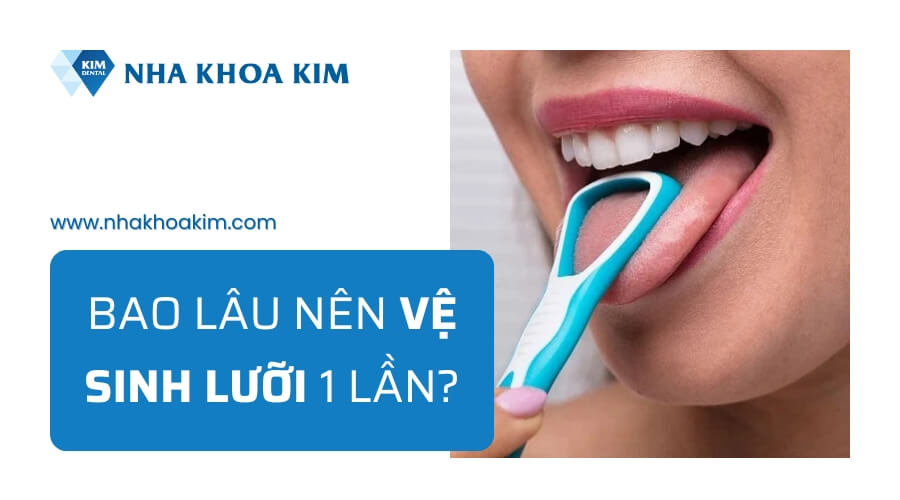 Bao lâu nên vệ sinh lưỡi?