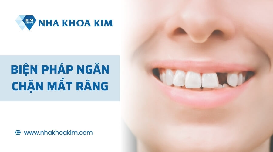 Biện pháp ngăn chặn mất răng