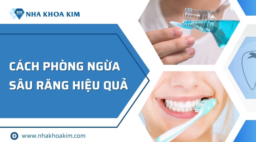 Cách phòng ngừa sâu răng hiệu quả
