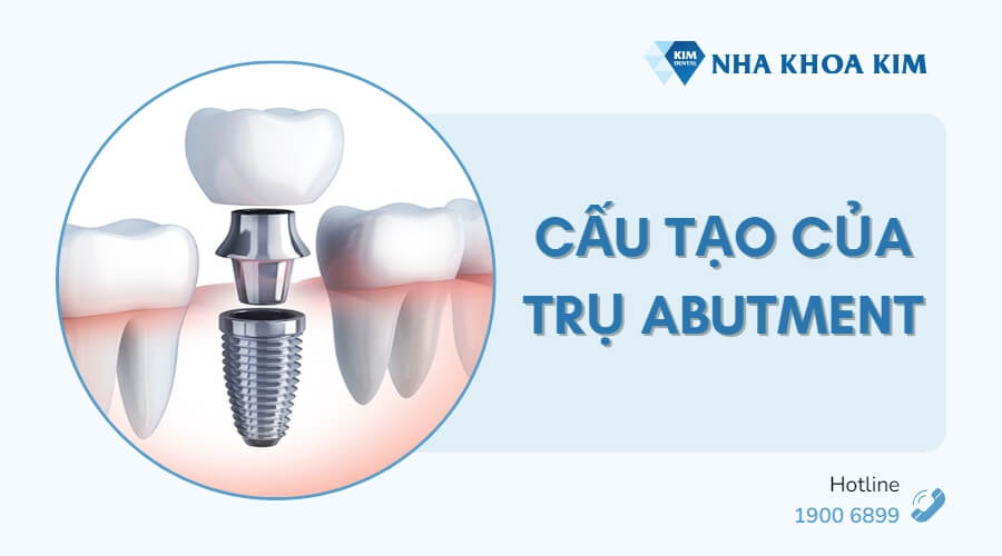 Cấu tạo của trụ Abutment Implant